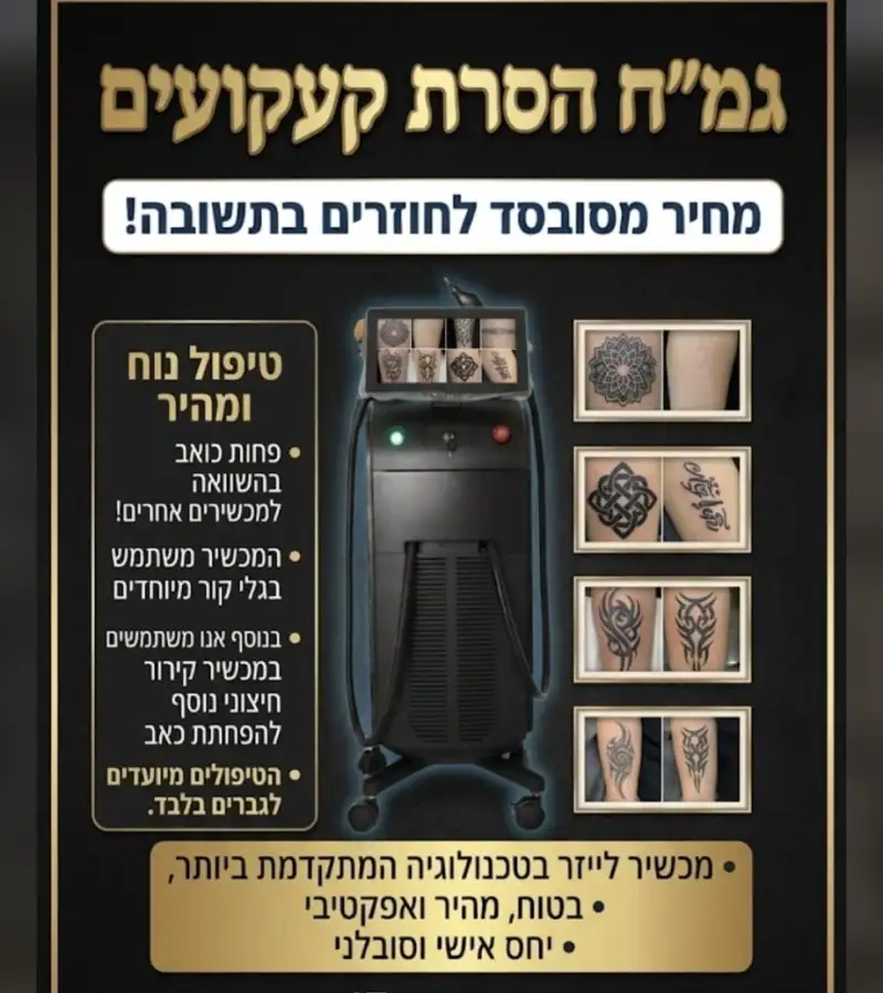 גמ״ח להשרת קעקועים
